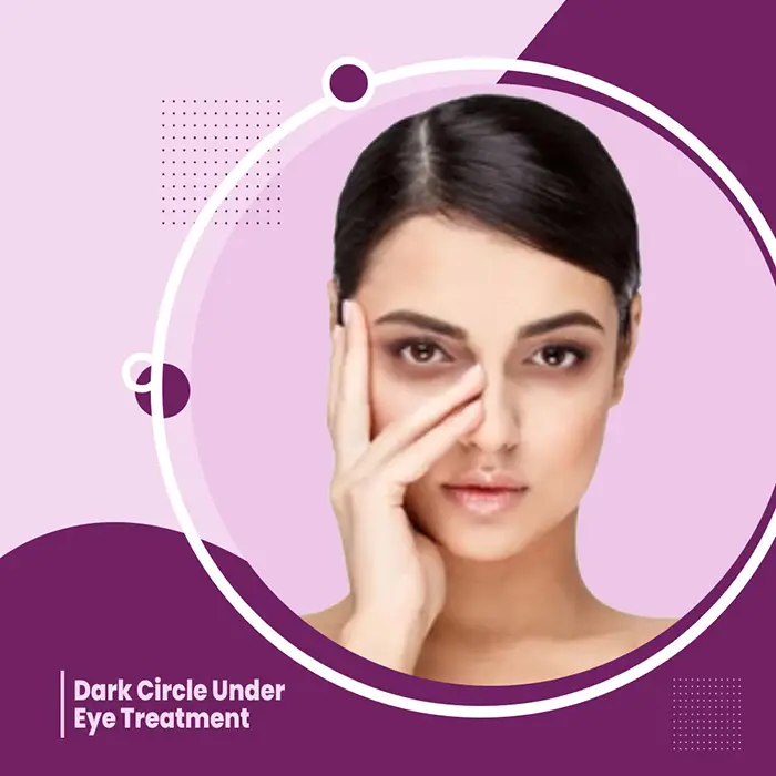 Best Under Eye Dark Circles Treatment