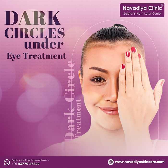 Best Under Eye Dark Circles Treatment