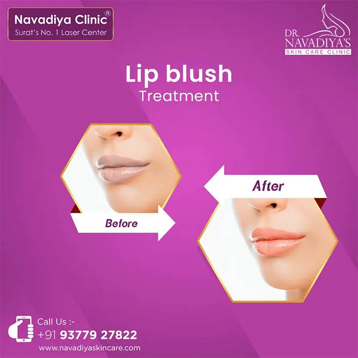 Lip Blush Treatment near me