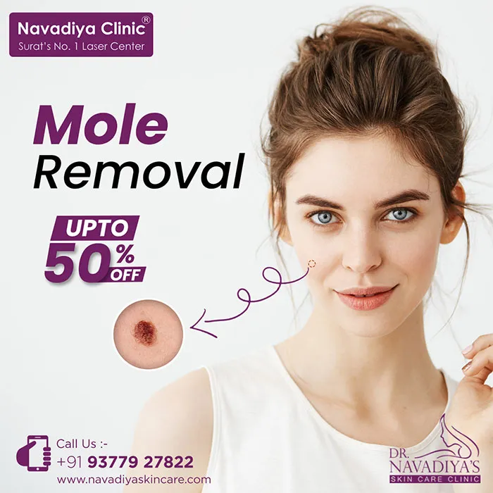 mole-removal