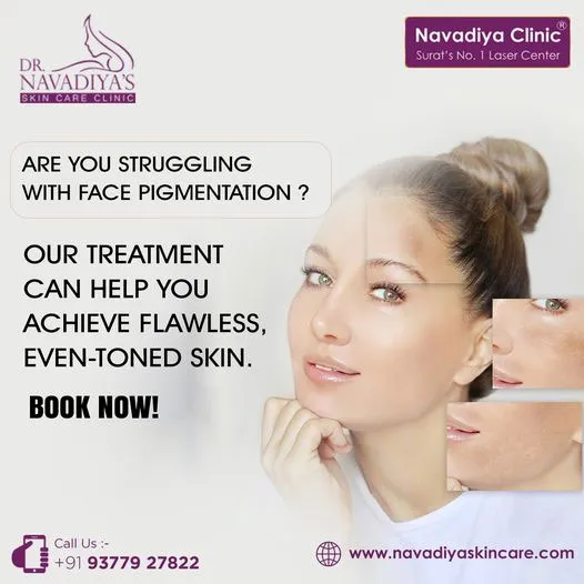 Pigmentation Removal Treatment