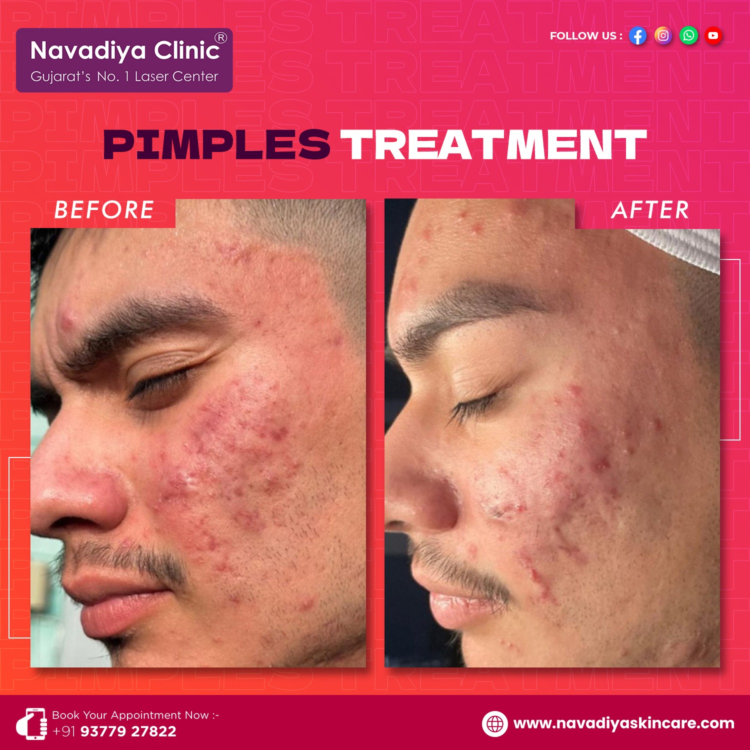 Best Doctors For Acne Treatment