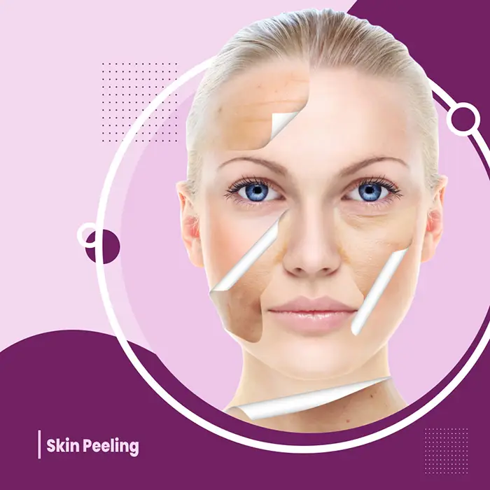 Skin Peeling